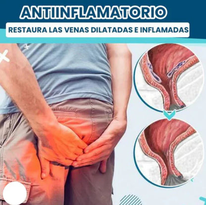 DICTAMNI SPRAY CALMA TOTAL HEMORROIDES