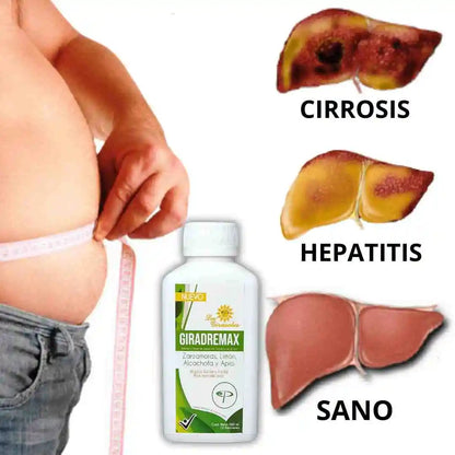 GIRADREMAX CONTROL COLESTEROL E HIGADO